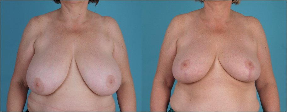 Martin Paciorek - Martin Paciorek