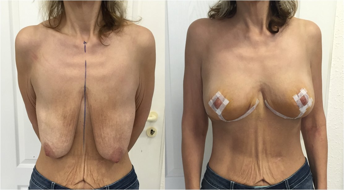 Martin Paciorek - Martin Paciorek