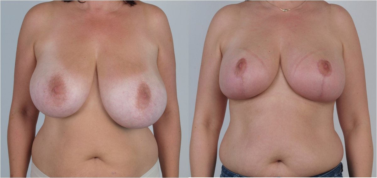 Martin Paciorek - Martin Paciorek