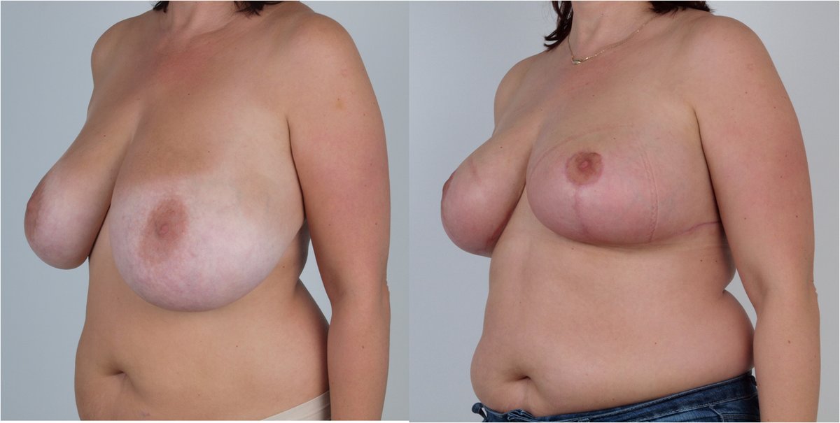 Martin Paciorek - Martin Paciorek