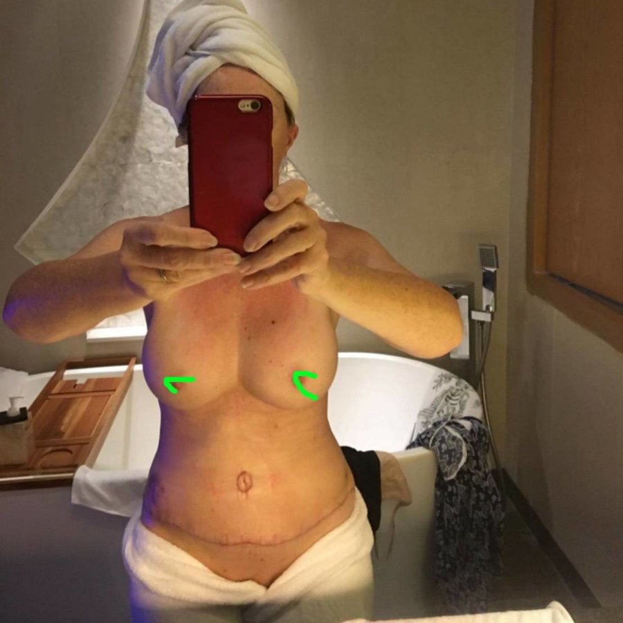 Maxi Cosmetic Surgery - Maxi Cosmetic Surgery