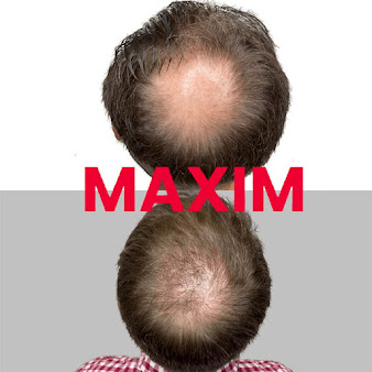 MAXIM Hair Restoration - New York City - MAXIM Hair Restoration - New York City
