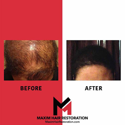 MAXIM Hair Restoration - New York City - MAXIM Hair Restoration - New York City