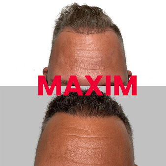 MAXIM Hair Restoration - New York City - MAXIM Hair Restoration - New York City