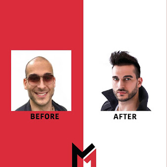 MAXIM Hair Restoration - New York City - MAXIM Hair Restoration - New York City