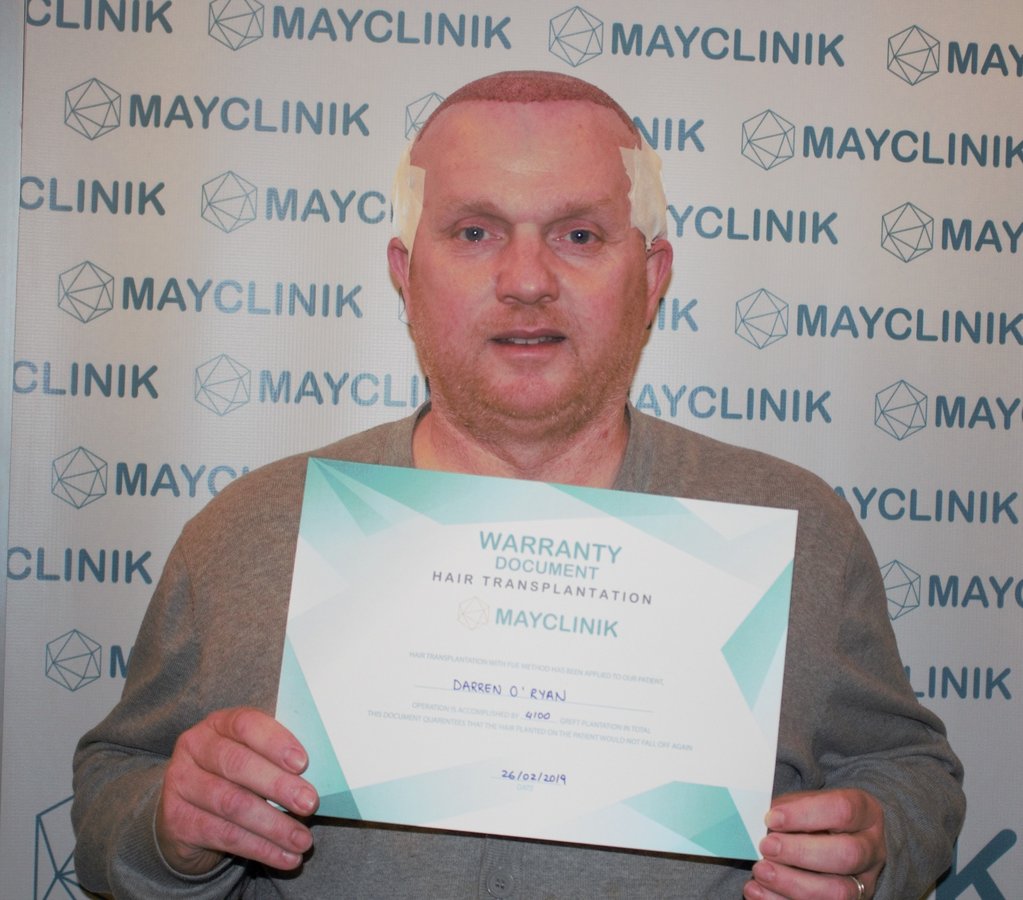 MayClinik Hair Transplant - MayClinik Hair Transplant