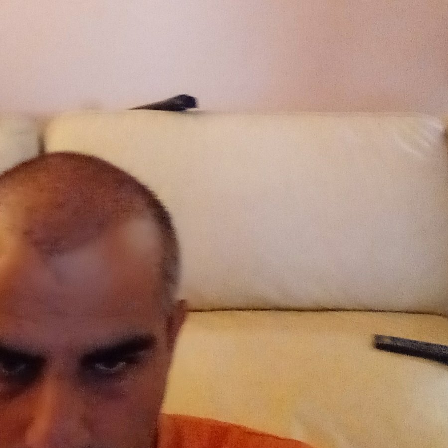 MCAN Health Hair Transplant - Kadikoy - MCAN Health Hair Transplant - Kadikoy