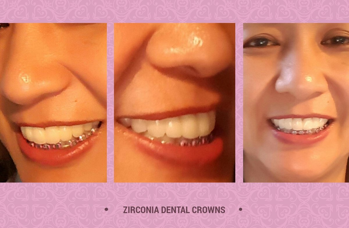 MD 14 Dental Hub - MD 14 Dental Hub