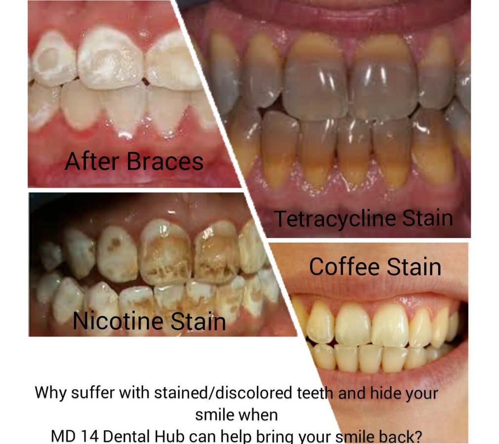 MD 14 Dental Hub - MD 14 Dental Hub