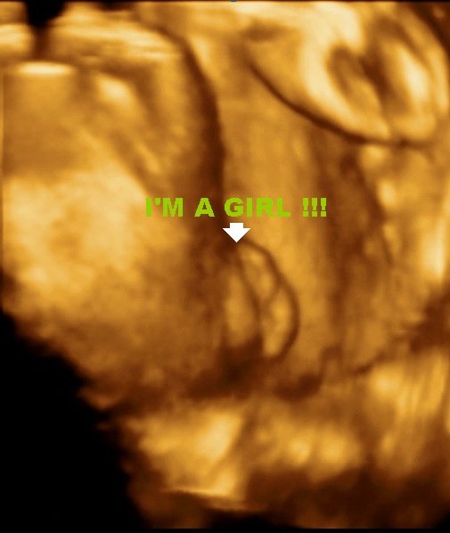 MDCARE OB-GYN ULTRASOUND CLINIC - MDCARE OB-GYN ULTRASOUND CLINIC