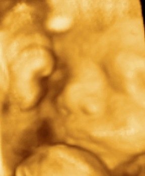 MDCARE OB-GYN ULTRASOUND CLINIC - MDCARE OB-GYN ULTRASOUND CLINIC