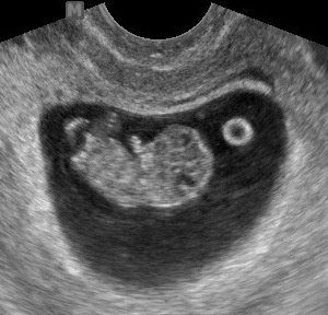 MDCARE OB-GYN ULTRASOUND CLINIC - MDCARE OB-GYN ULTRASOUND CLINIC