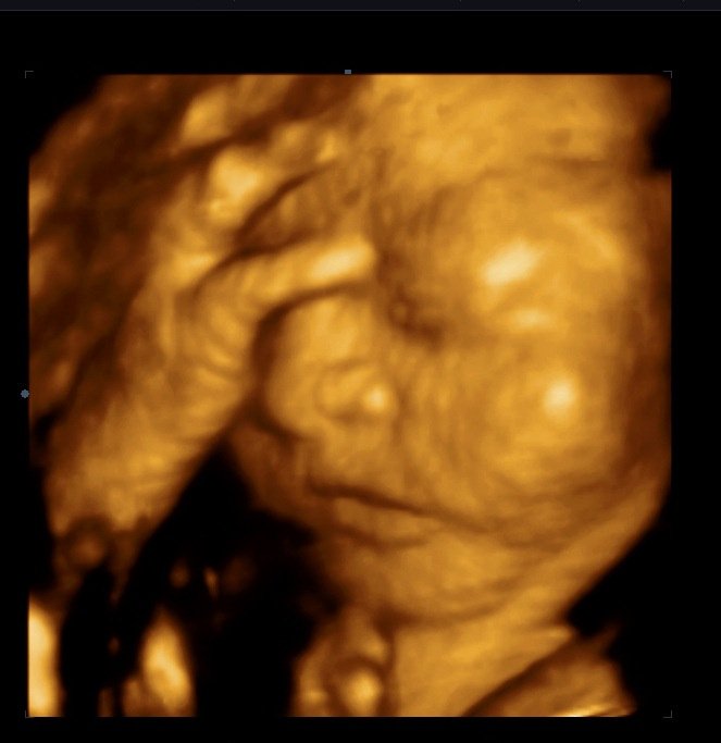 MDCARE OB-GYN ULTRASOUND CLINIC - MDCARE OB-GYN ULTRASOUND CLINIC