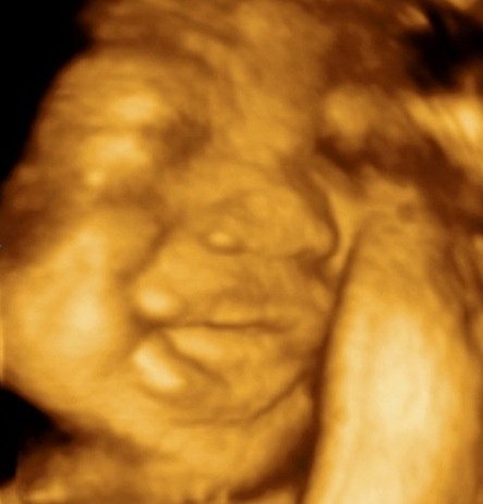 MDCARE OB-GYN ULTRASOUND CLINIC - MDCARE OB-GYN ULTRASOUND CLINIC