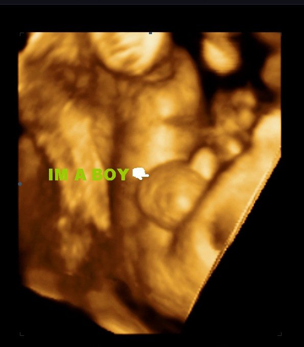 MDCARE OB-GYN ULTRASOUND CLINIC - MDCARE OB-GYN ULTRASOUND CLINIC