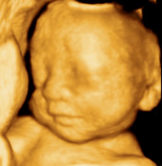 MDCARE OB-GYN ULTRASOUND CLINIC - MDCARE OB-GYN ULTRASOUND CLINIC