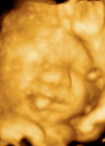 MDCARE OB-GYN ULTRASOUND CLINIC - MDCARE OB-GYN ULTRASOUND CLINIC