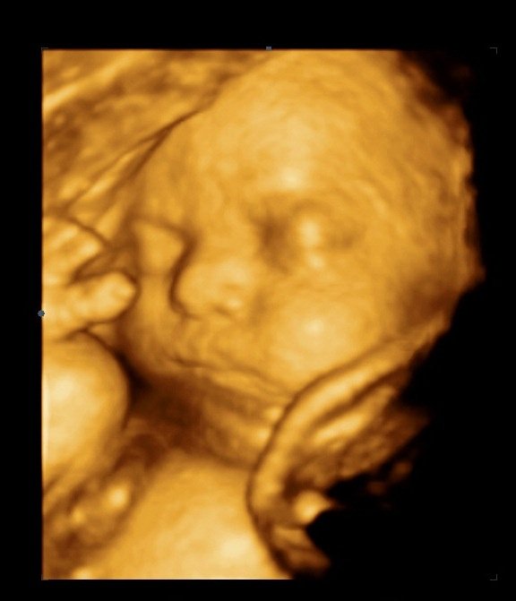 MDCARE OB-GYN ULTRASOUND CLINIC - MDCARE OB-GYN ULTRASOUND CLINIC