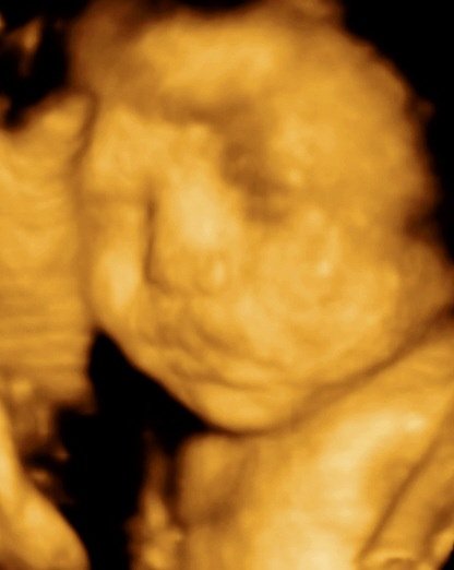 MDCARE OB-GYN ULTRASOUND CLINIC - MDCARE OB-GYN ULTRASOUND CLINIC