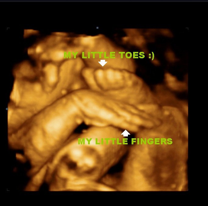 MDCARE OB-GYN ULTRASOUND CLINIC - MDCARE OB-GYN ULTRASOUND CLINIC