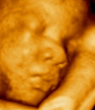 MDCARE OB-GYN ULTRASOUND CLINIC - MDCARE OB-GYN ULTRASOUND CLINIC