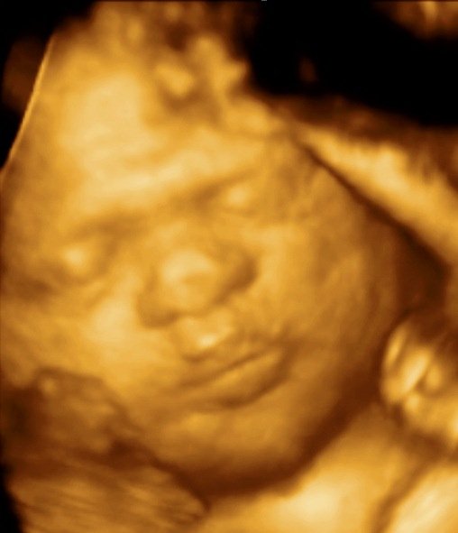 MDCARE OB-GYN ULTRASOUND CLINIC - MDCARE OB-GYN ULTRASOUND CLINIC