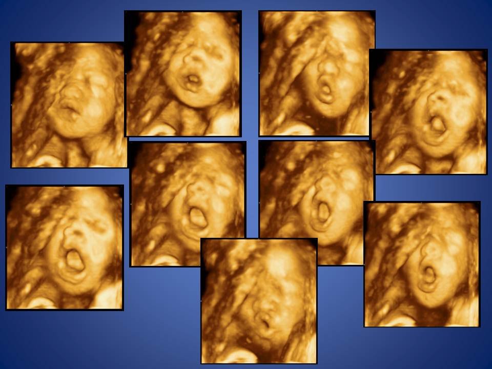 MDCARE OB-GYN ULTRASOUND CLINIC - MDCARE OB-GYN ULTRASOUND CLINIC