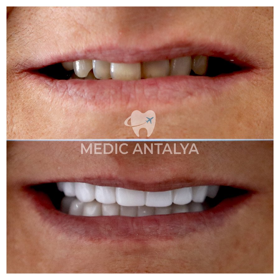 Medic Antalya Dental Clinic - Medic Antalya Dental Clinic