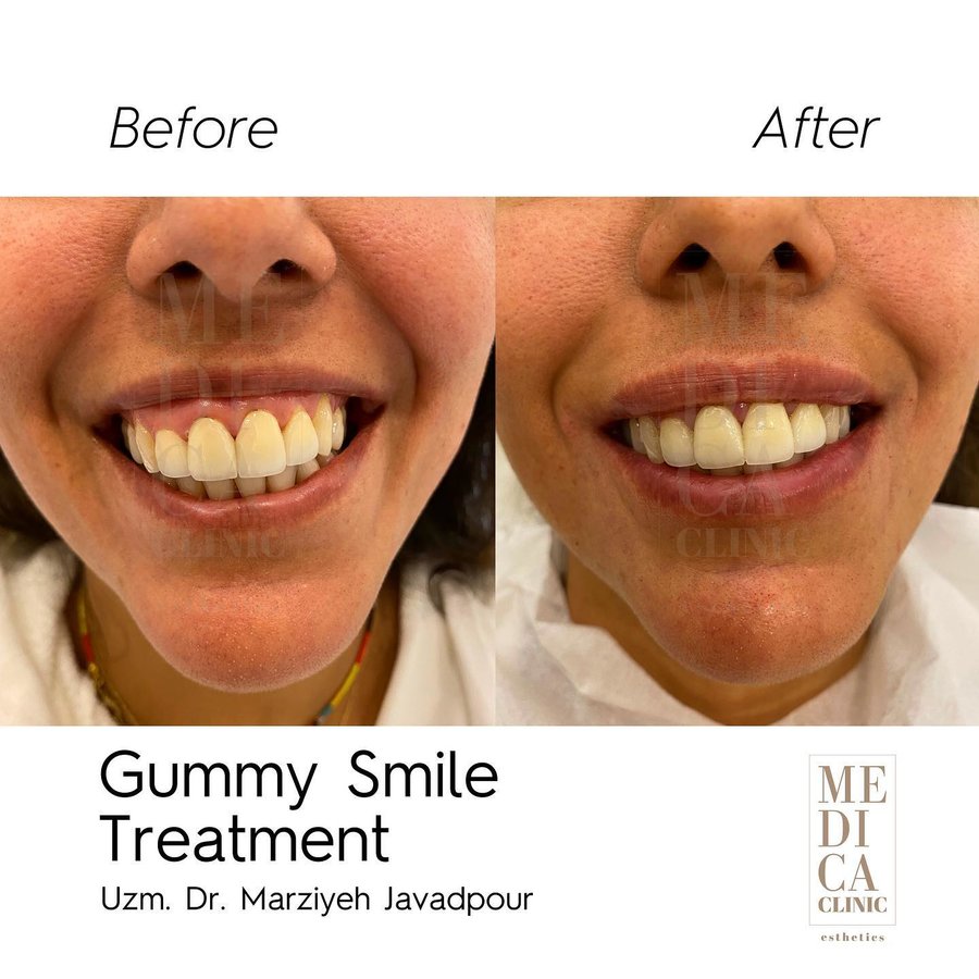 عيادة ميديكا التجميلية - Medica Clinic Esthetics