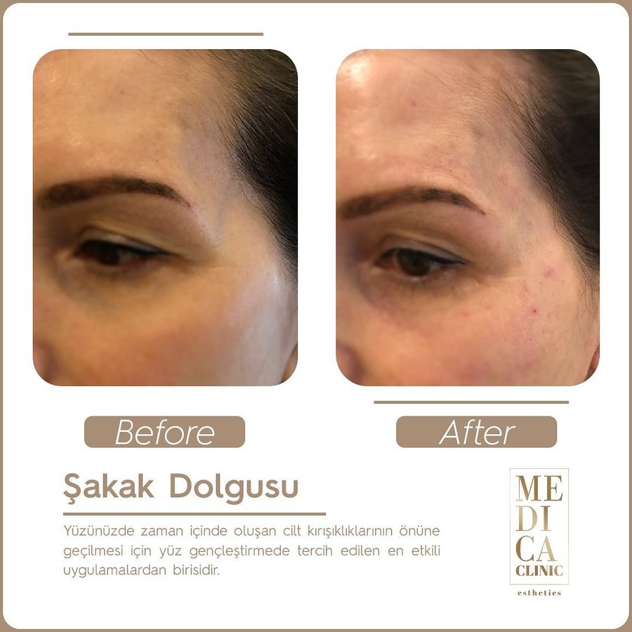 عيادة ميديكا التجميلية - Medica Clinic Esthetics