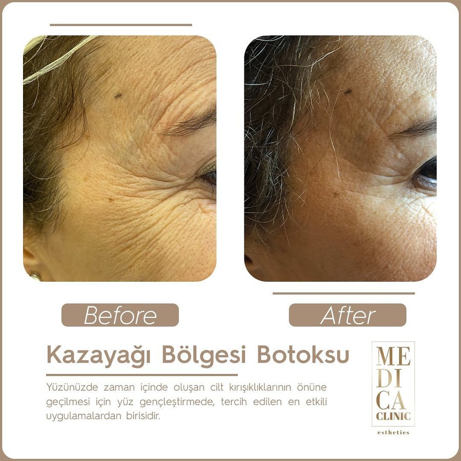عيادة ميديكا التجميلية - Medica Clinic Esthetics