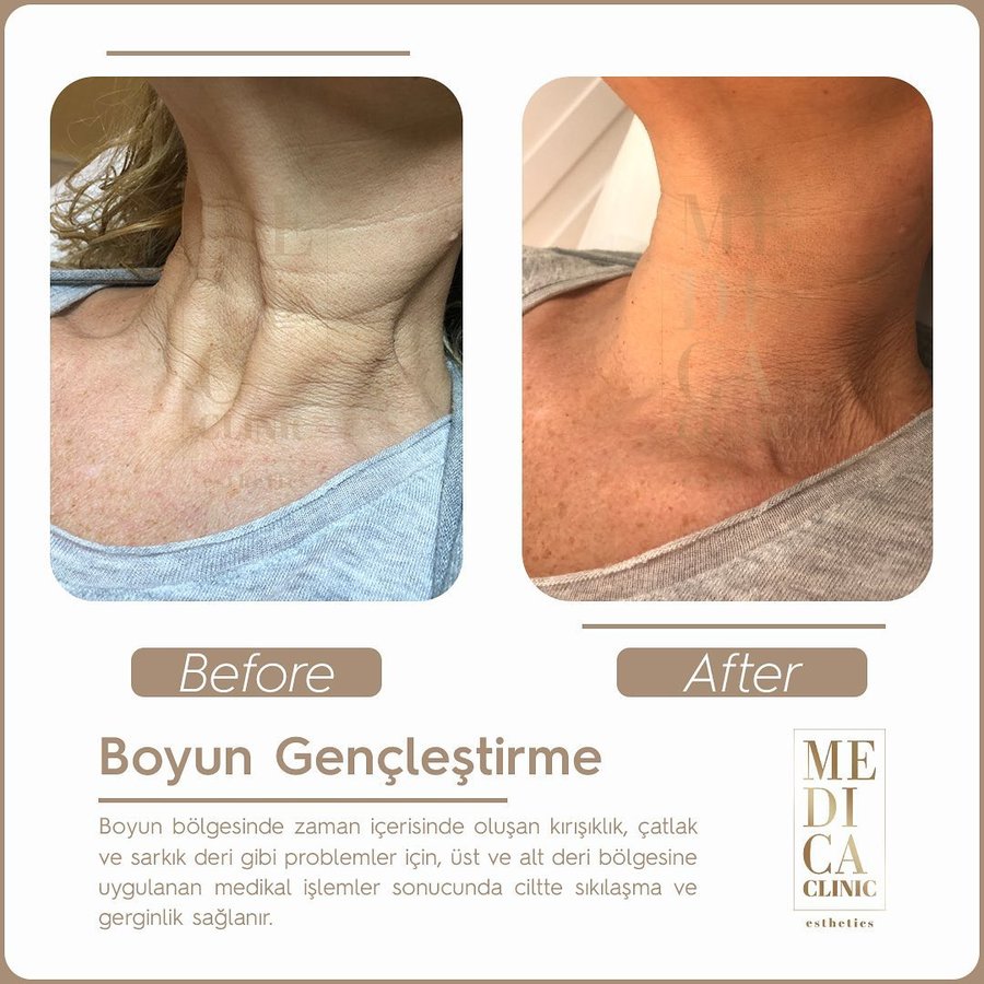عيادة ميديكا التجميلية - Medica Clinic Esthetics