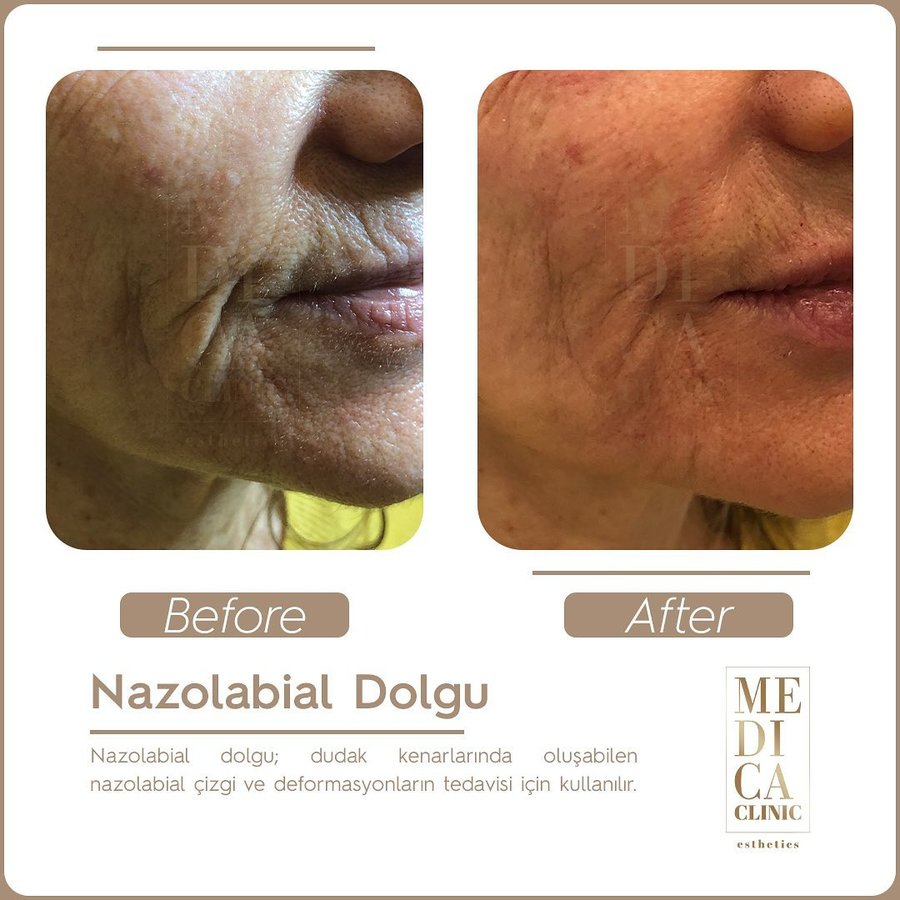 عيادة ميديكا التجميلية - Medica Clinic Esthetics