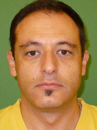 Medical Centre for Plastic Surgery -Dr. Nikolay Georgiev - Medical Centre for Plastic Surgery -Dr. Nikolay Georgiev