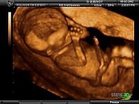 Medical Diagnostic Ultrasound - Medical Diagnostic Ultrasound