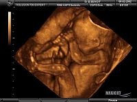 Medical Diagnostic Ultrasound - Medical Diagnostic Ultrasound