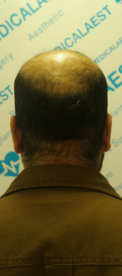 Medicalaest - Medicalaest