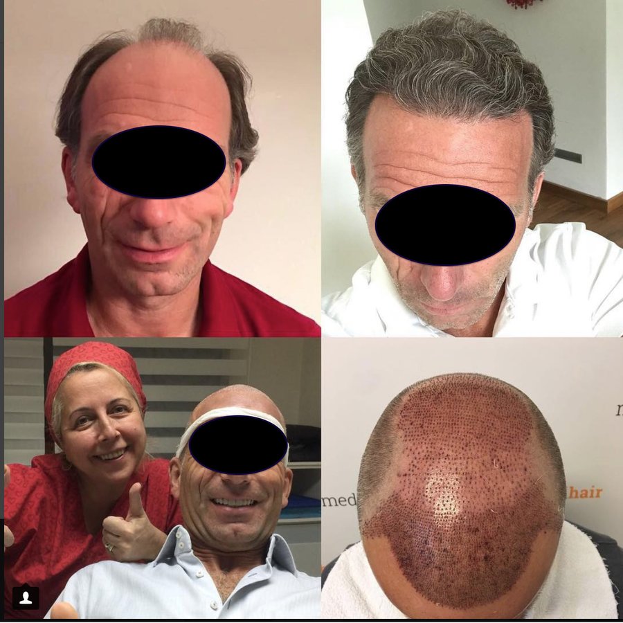 Medicalhair Turkey - Dr. Sibel Ulusan - Medicalhair Turkey - Dr. Sibel Ulusan