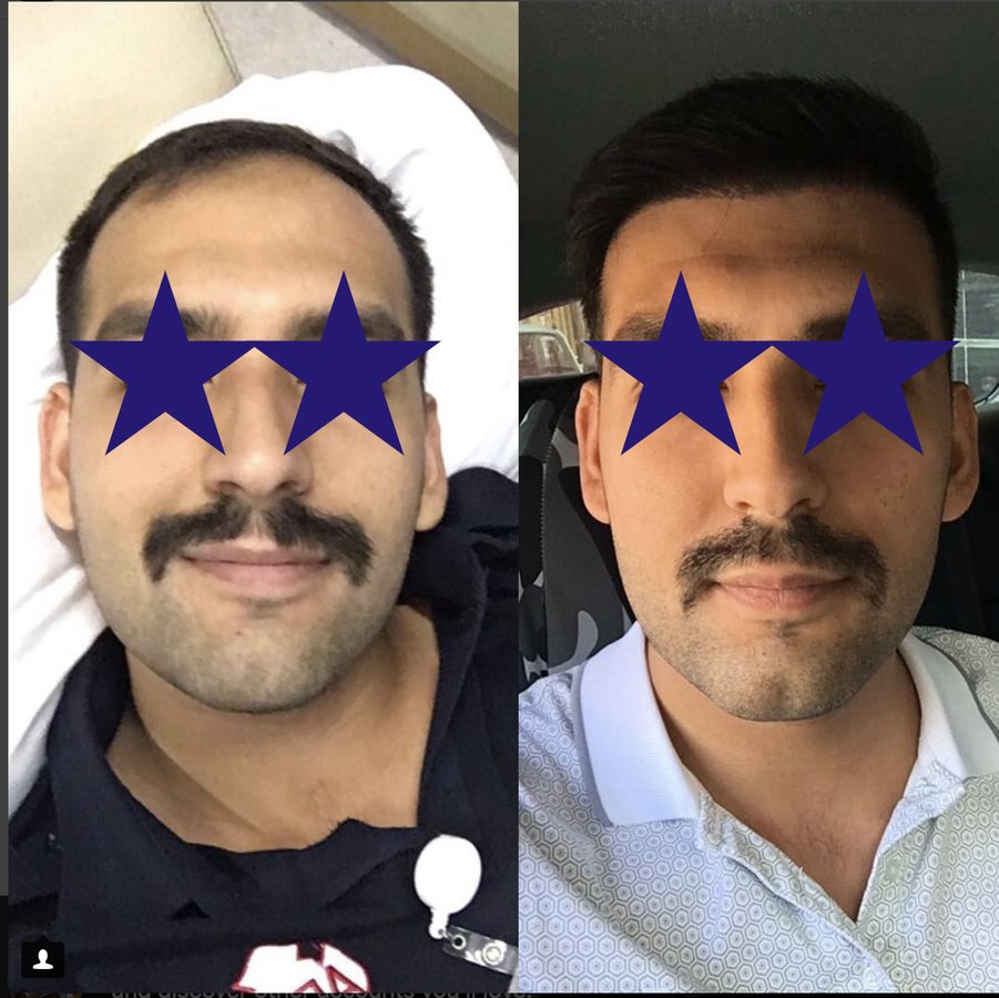 Medicalhair Turkey - Dr. Sibel Ulusan - Medicalhair Turkey - Dr. Sibel Ulusan