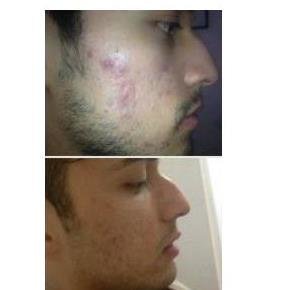 Medicina Estética Regenerativa - Medicina Estética Regenerativa