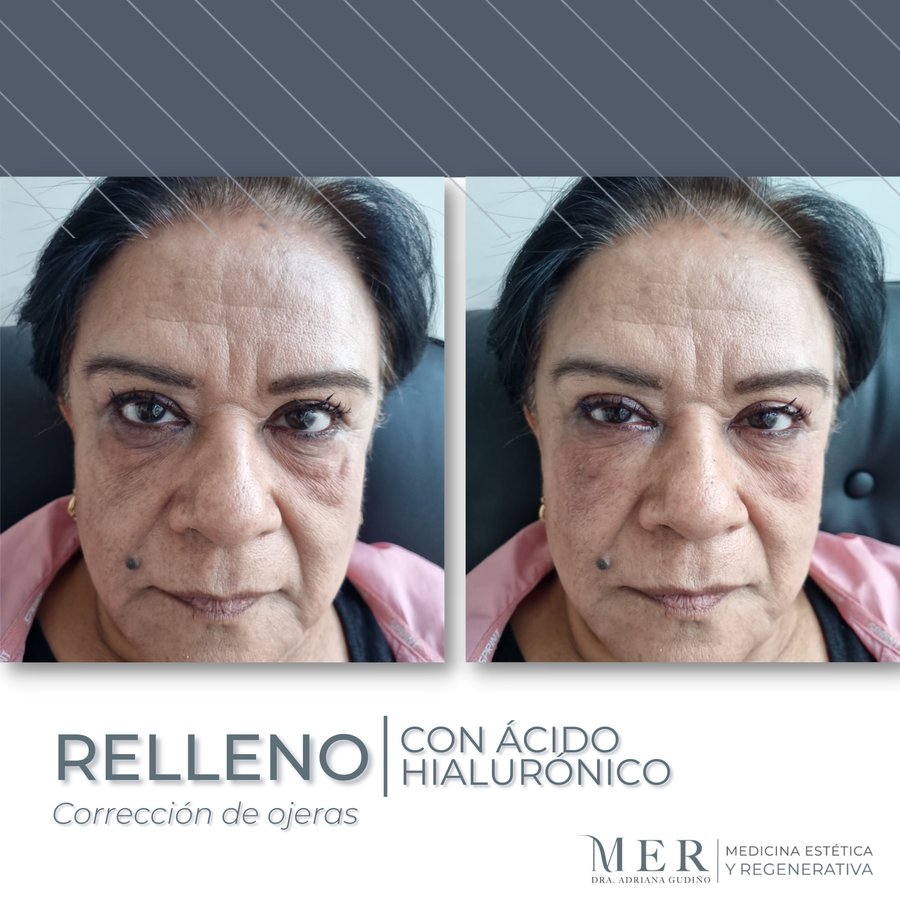 Medicina Estética Regenerativa - Medicina Estética Regenerativa