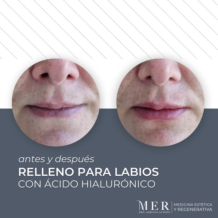 Medicina Estética Regenerativa - Medicina Estética Regenerativa