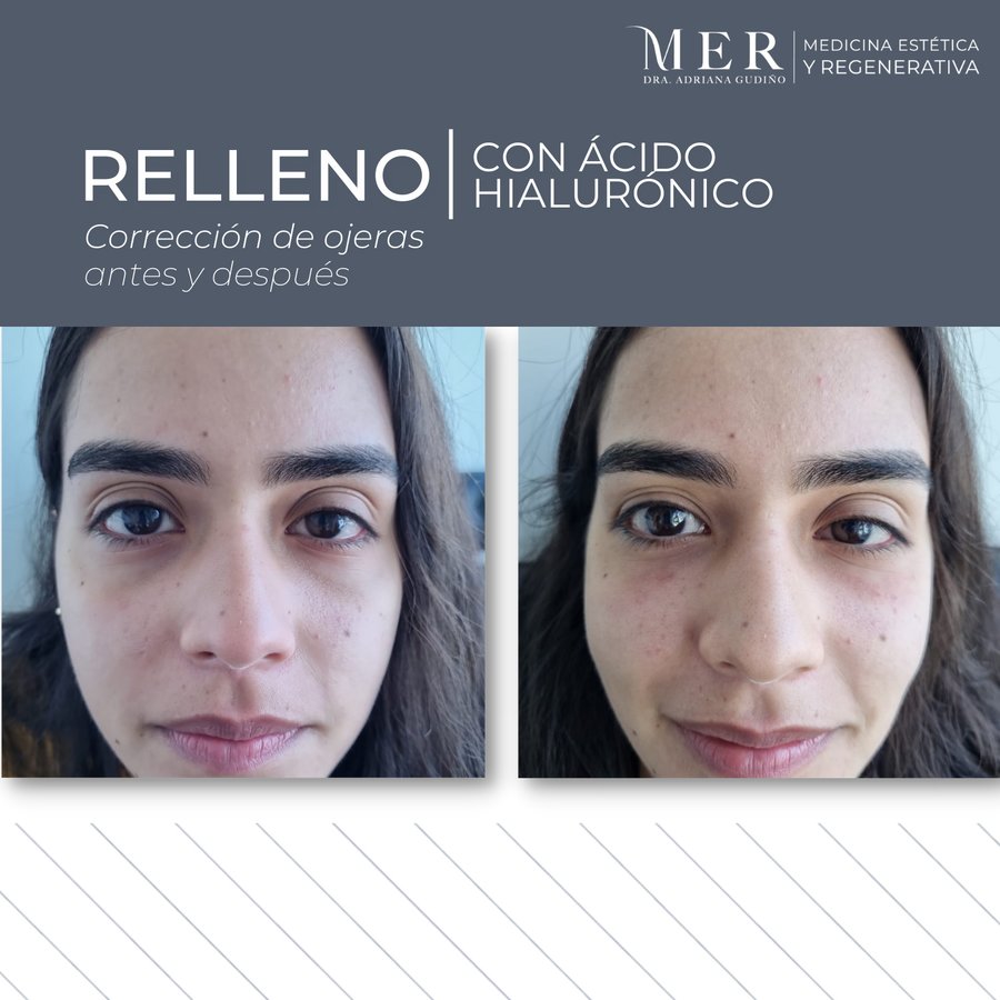 Medicina Estética Regenerativa - Medicina Estética Regenerativa