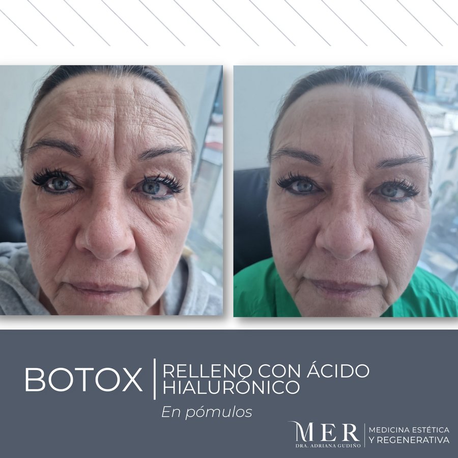 Medicina Estética Regenerativa - Medicina Estética Regenerativa