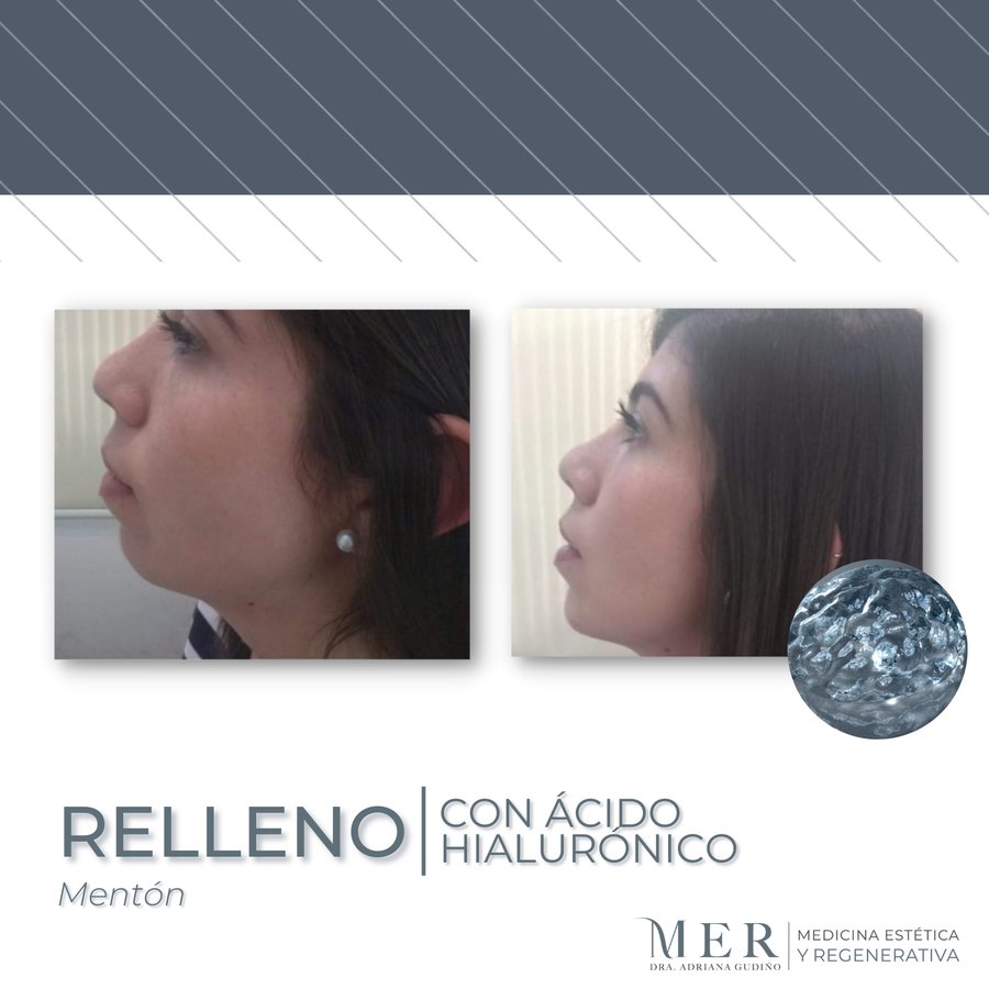 Medicina Estética Regenerativa - Medicina Estética Regenerativa