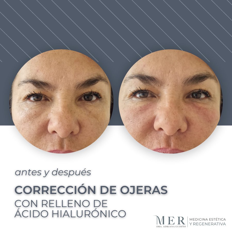 Medicina Estética Regenerativa - Medicina Estética Regenerativa