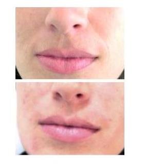 Medicina Estética Regenerativa - Medicina Estética Regenerativa