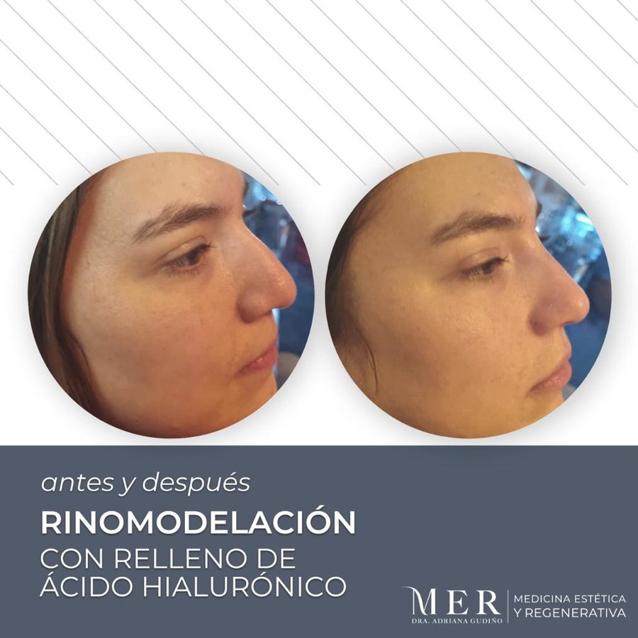 Medicina Estética Regenerativa - Medicina Estética Regenerativa