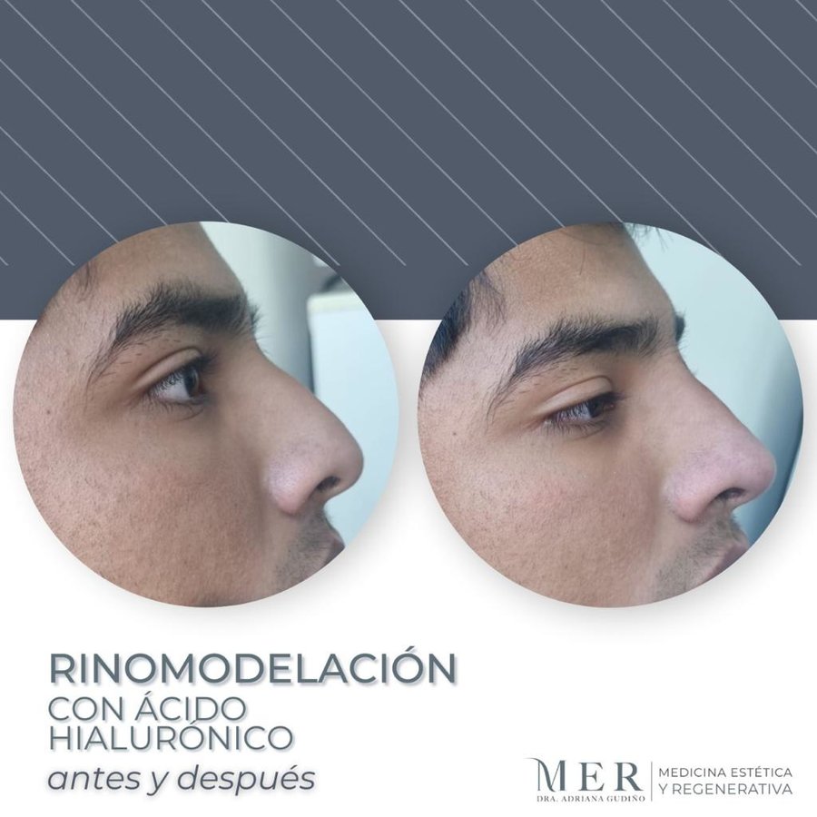 Medicina Estética Regenerativa - Medicina Estética Regenerativa