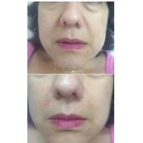 Medicina Estética Regenerativa - Medicina Estética Regenerativa